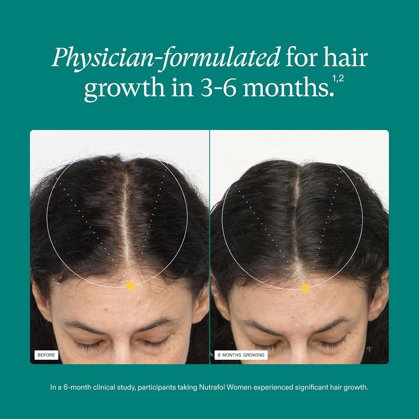 Nutrafol Women's Hair Growth Supplements - Clinically Proven Formula for Thicker, Stronger Hair | 1 Month Supply