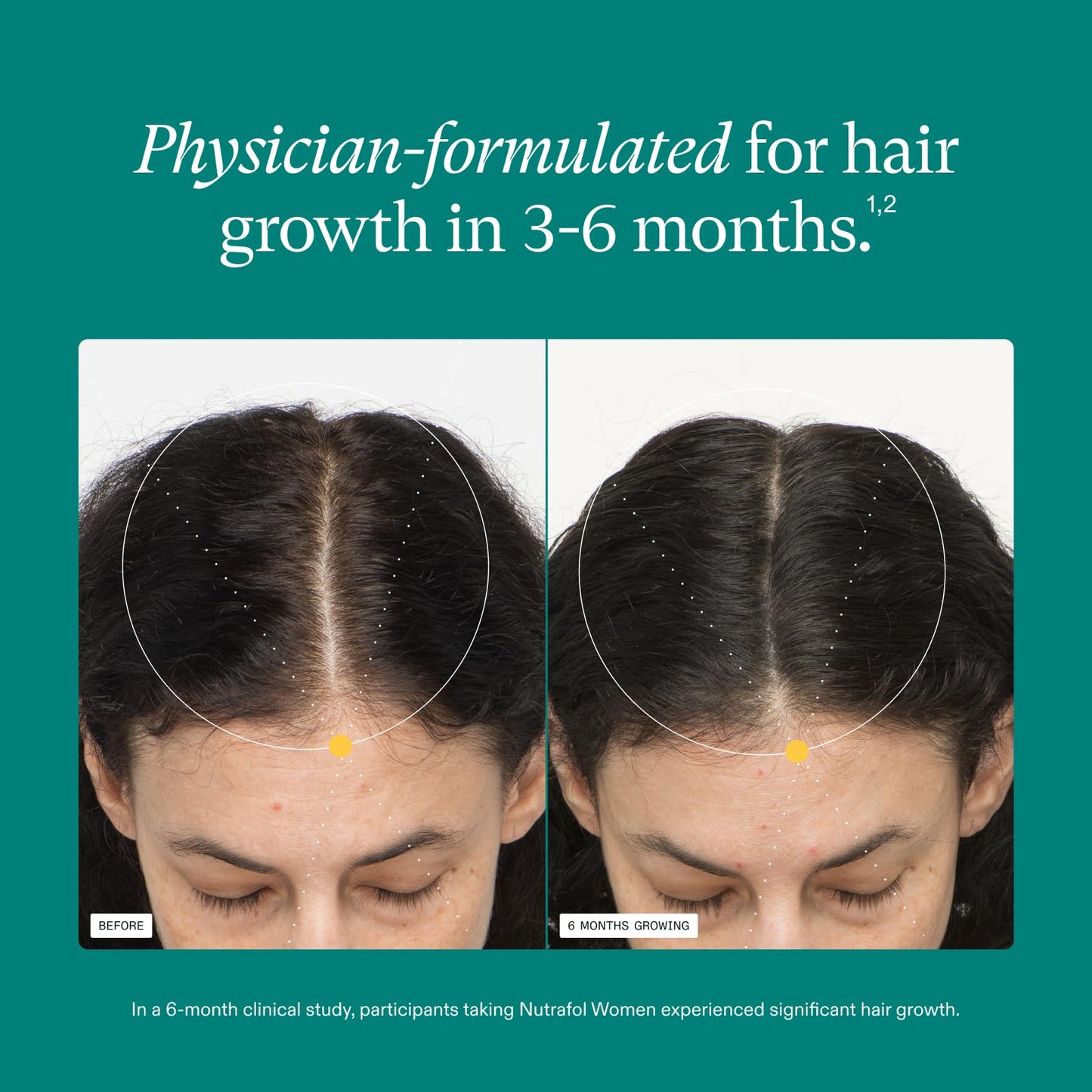 Nutrafol Women's Hair Growth Supplements, For Women 18-44 Years Old, Clinically Proven for Visibly Thicker and Stronger Hair, Dermatologist Recommended - 3 Month Supply, Pack of 3
