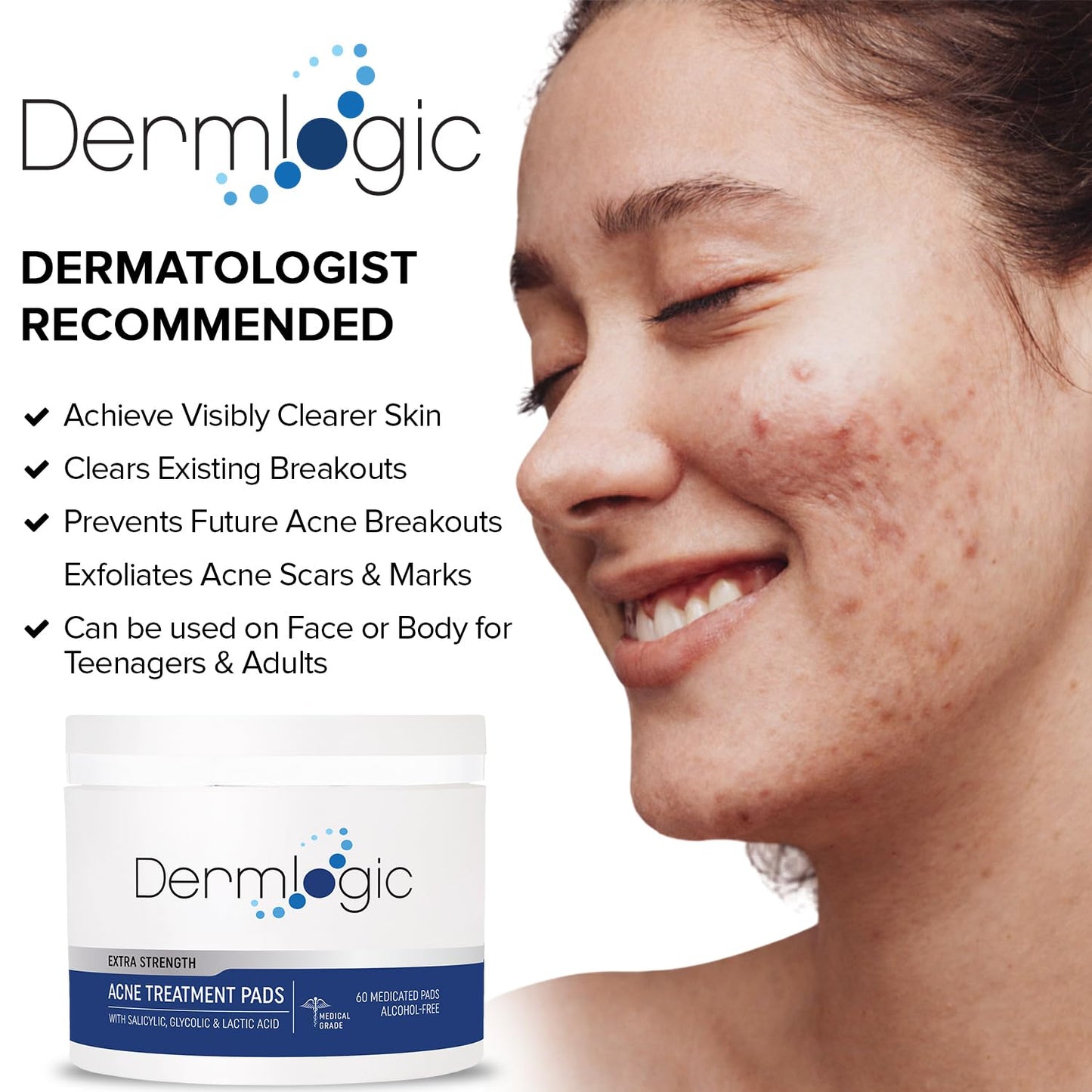 Acne Treatment Pads- Contains Salicylic, Glycolic, & Lactic Acid for Face & Body. Clears Away Clogged Pores, Oily Skin & Cystic Breakouts. Removes Dark Spots, Blackhead & Whitehead Pimples