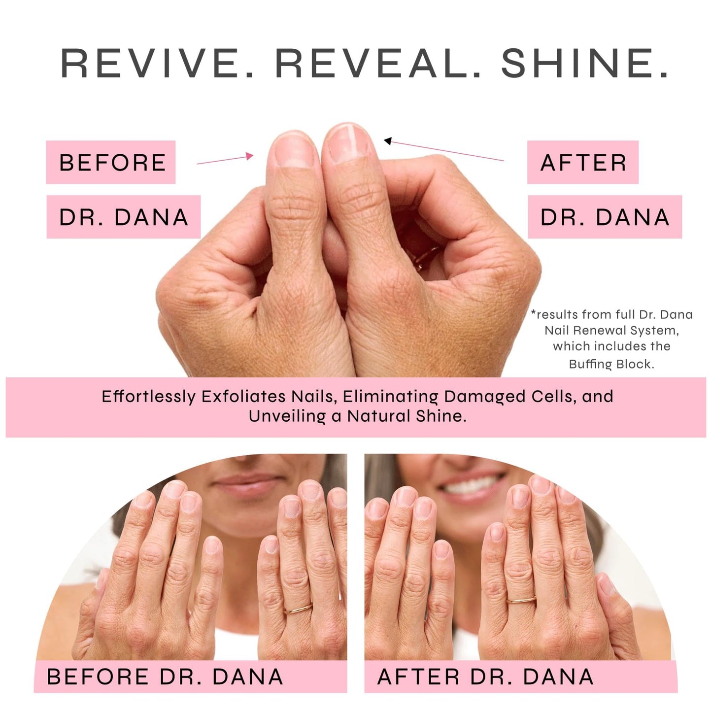 Dr. Dana Nail Buffing Block Set - Gently Smooth, Shine, and File Natural Nails with Professional Buffer (3 Sided Grit) - Also Includes Replacement Grits - Ideal for Fingernail & Toe