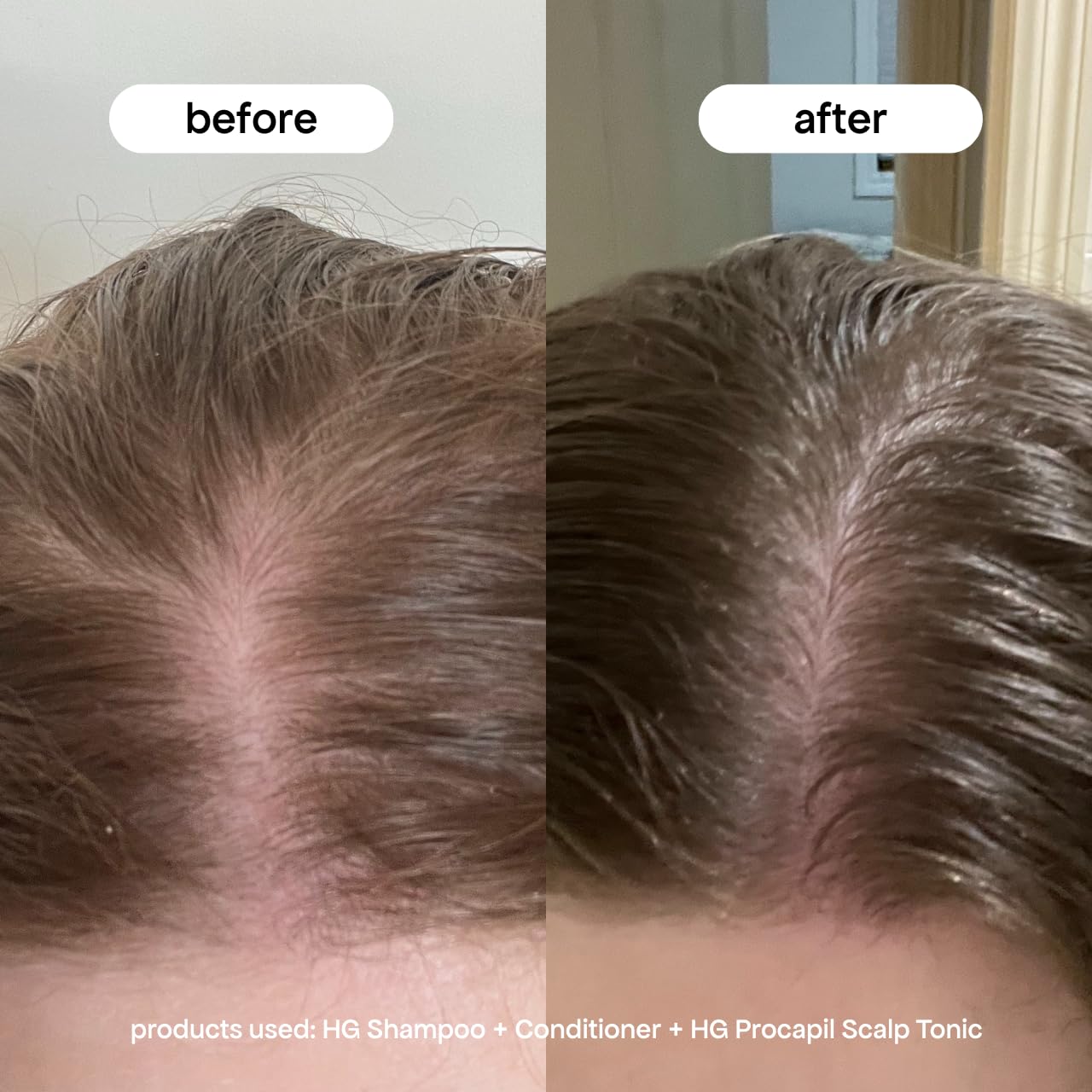 BONDIBOOST Procapil Scalp Treatment [4.23 fl oz], Daily Leave In Treatment for Thinning Hair + Anchor Hair, Scalp Serum for Thicker Hair with Procapil, Rosemary & Biotinoyl Tripeptide-1, Sulfate-Free