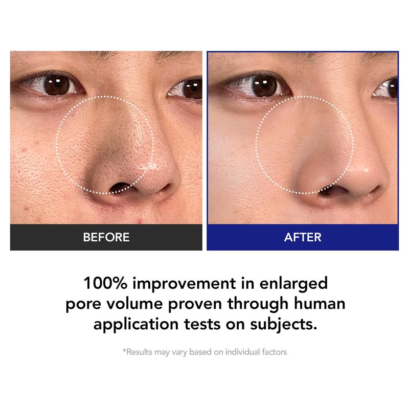 Brightening Exfoliating Pads | 35% Smaller Pores | AHA BHA PHA Exfoliation for Pores & Texture | Brightening & Hydrating Korean Skincare| Sensitive & Acne-Prone Skin | 70 Pads