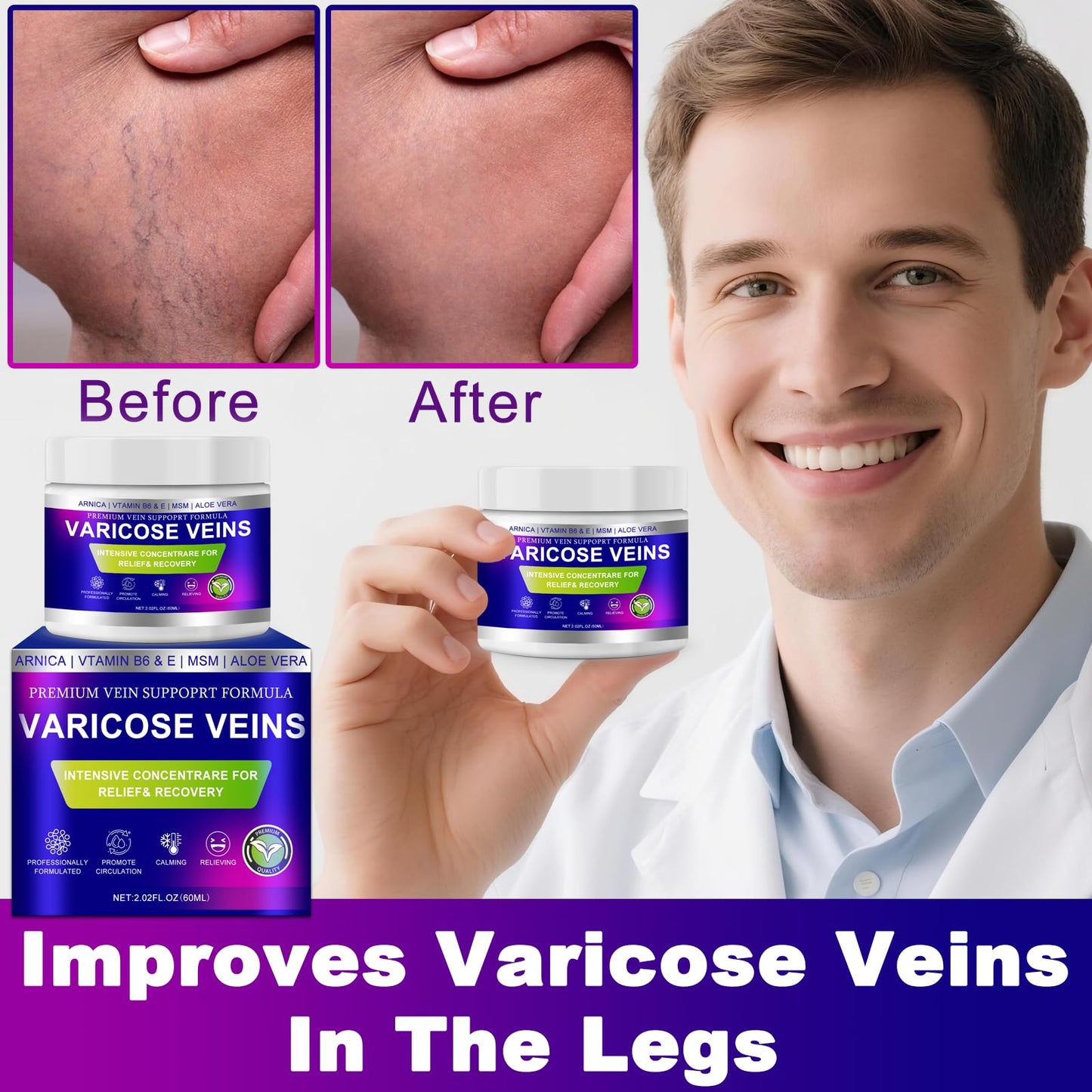 Yongsenina Varicose Veins Cream, Vein Cream & Spider Veins Treatment for Legs, Improves Blood Circulation and Relief From Heavy Fatigued Leg, Refreshing and Non-Sticky, 2PK