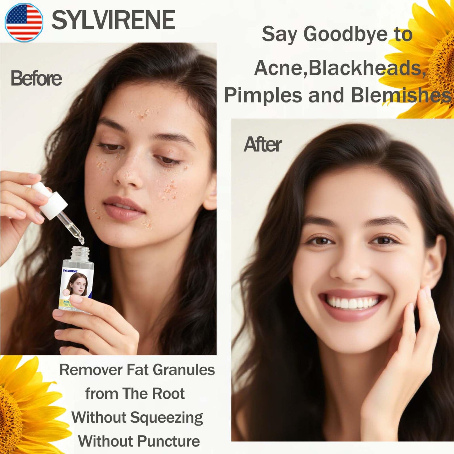 Sylvirene 40 ml Milia Remover Serum for Eyes & Face, Milia Removal Essence, Milia Spot Remover Serum for Clear Skin