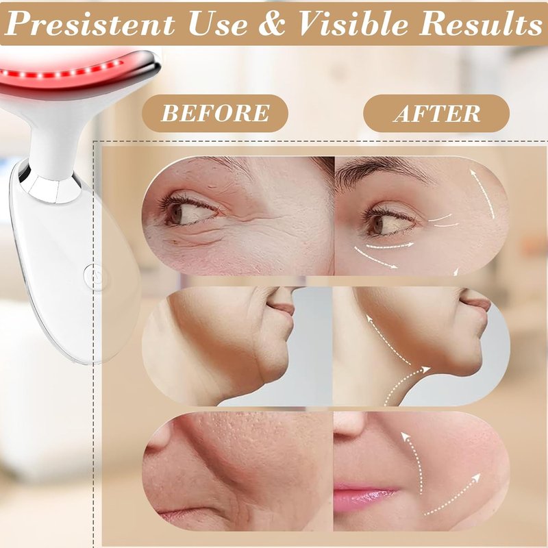 Facial Massager - Skin Tightening Face Roller for Anti-Aging & Wrinkle Reduction | White