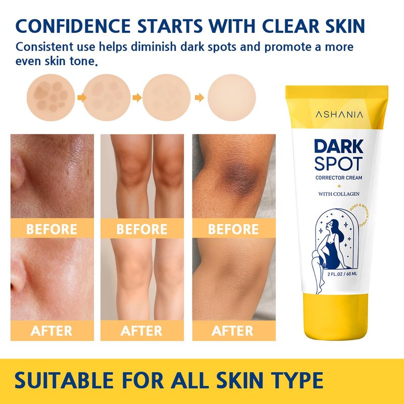 Dark Spot Remover for Face & Body - Advanced Corrector for Inner Thighs, Neck & Knees | 2 Fl Oz