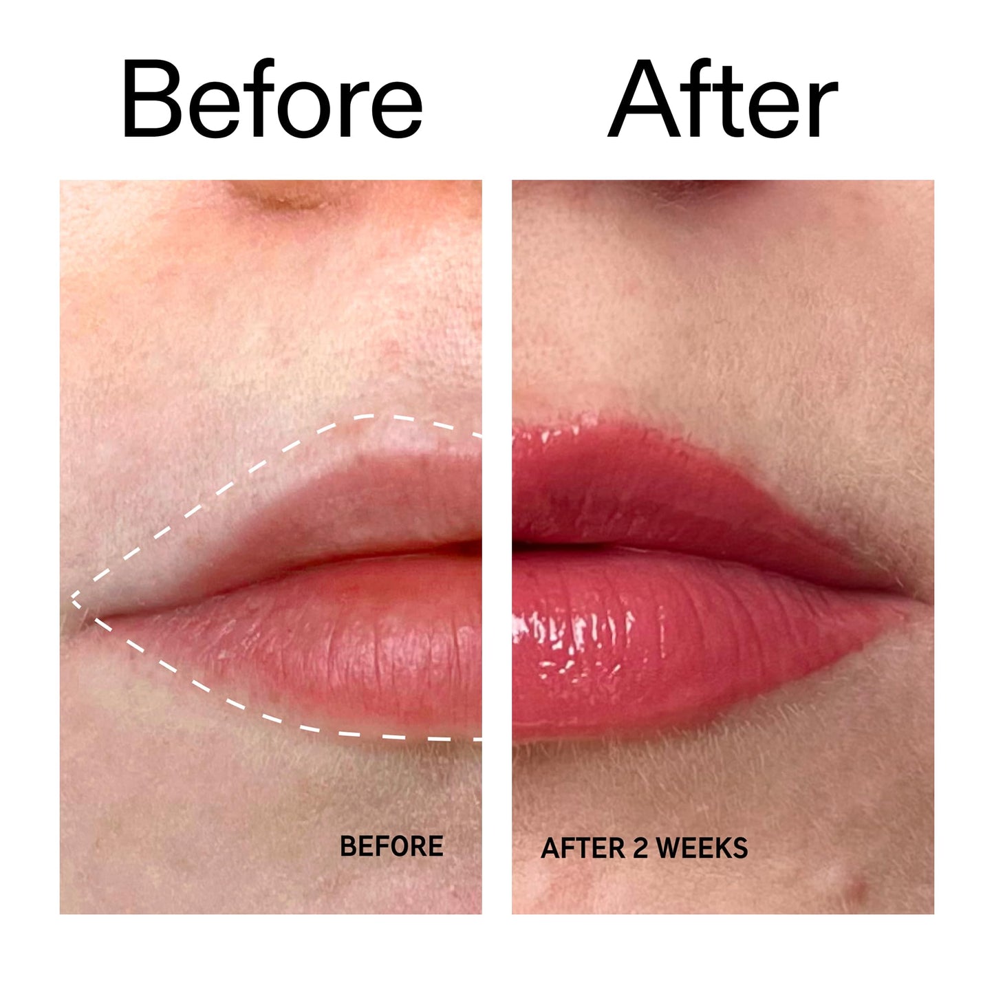 The INKEY List Tripeptide Plumping Lip Balm 10ml, Clinically Proven Plumping Tinted Lip Care, Hydrates Dry Cracked Lips, Vegan & Cruelty Free
