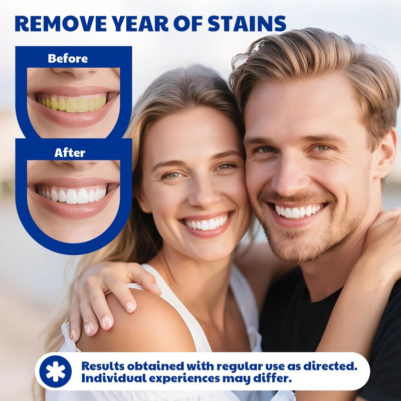 KTSAY Teeth Whitening Pen - Effective Stain Removal Teeth Whitening Gel