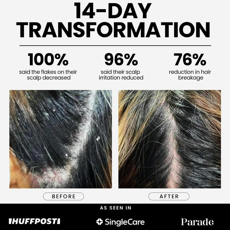 DANDRX Anti-Dandruff Shampoo and Conditioner with 2% Pyrithione Zinc & Stem Cells, Extra Strength for Flaky, Itchy, Oily & Dry Scalp Treatment, Fragrance Free, Color Safe, Sulfate Free