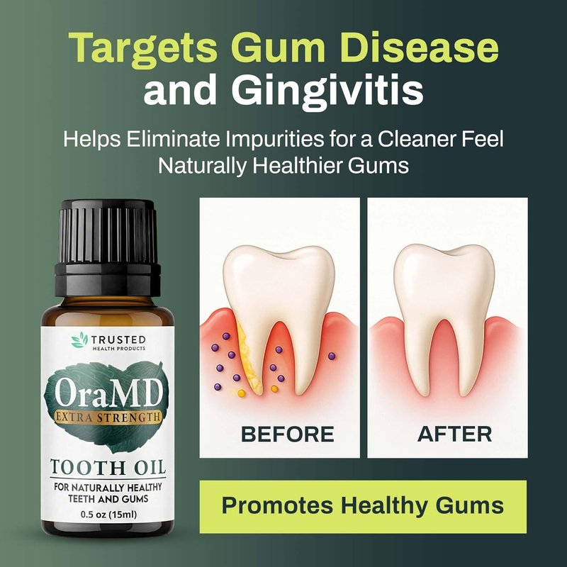 OraMD 4-in-1 Tooth Oil - Extra Strength Gum Disease & Gingivitis Treatment | All-Natural Formula (1 Pack)
