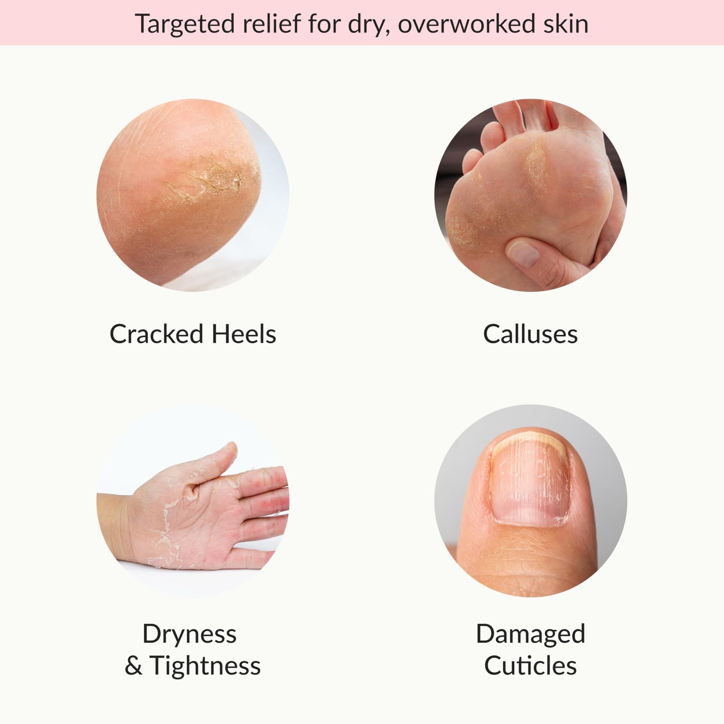 Epielle Moisturizing Hand & Foot Masks, Soften Dry Skin with Sunflower Seed Oil & Vitamin E, Self Care Gifts for Women, Spa Kit, 6 Moisturizing Gloves & 6 Moisturizing Socks