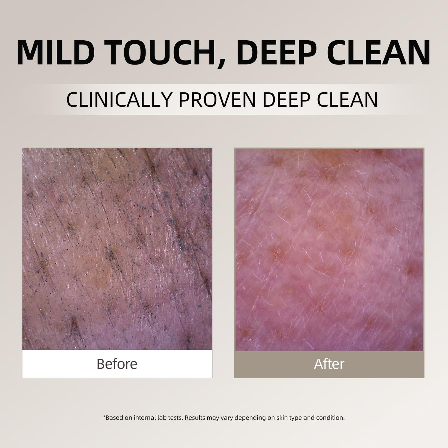 DEEOM Real Yam Brightening Cleanser, Gentle Foaming Face Wash for Sensitive Skin with Rice Water, Hydrating & Deep Pore Cleansing, Korean Skincare, 6.76 oz