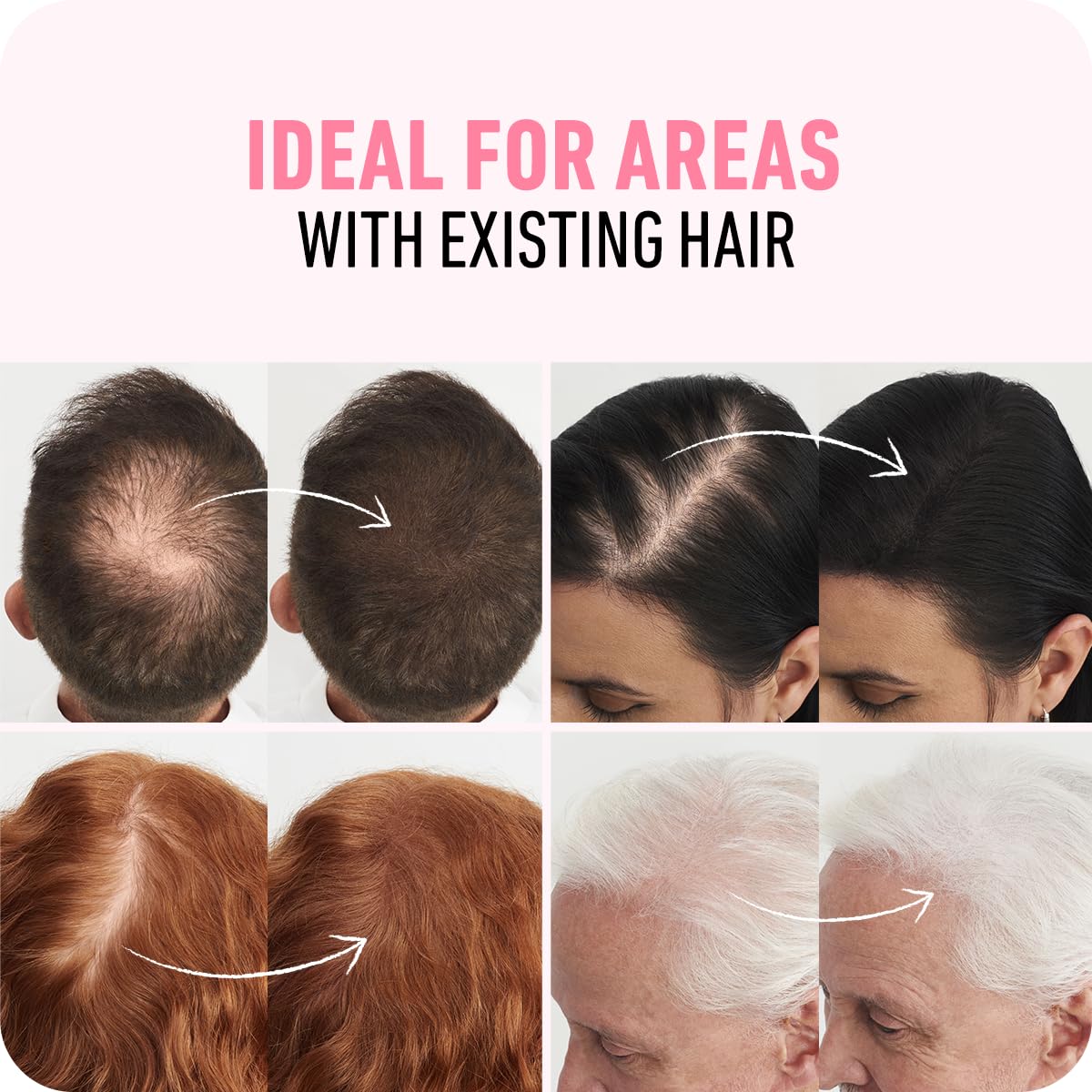 BOLDIFY Hair Fibers - Fill In Thinning and Fine Hair for an Instantly Fuller, Thicker Look - 14 Shades for Women & Men