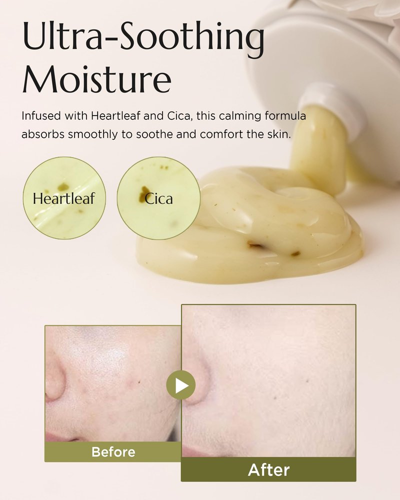 CHICHO Korean Calming Gel-Cream - 68.8% Heartleaf & 6-Cica Redness Relief Moisturizer, Non-Comedogenic Lightweight Face Cream for Sensitive Acne Prone Skin, Vegan Clean, 2.37 fl oz