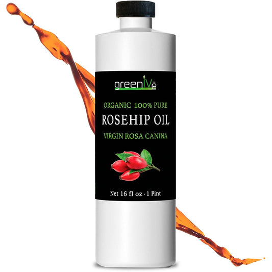 Rosehip Oil - 100% Pure Cold Pressed Virgin Oil | Organic Rosa Canina (16 Fl Oz)