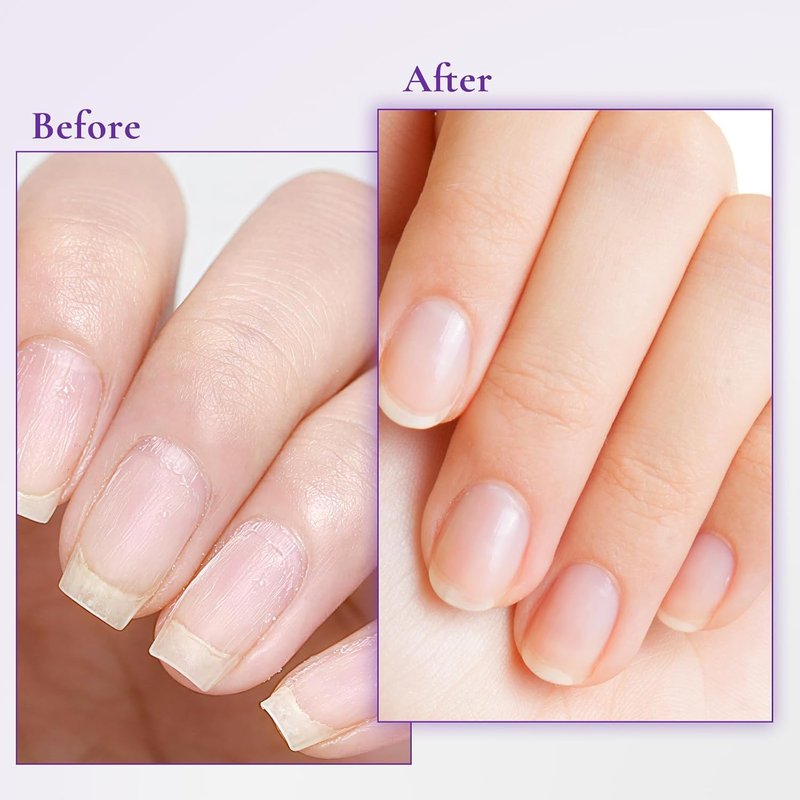 Nail & Cuticle Cream with Keratin, Biotin & Ceramides - Non-Greasy Deep Hydration | 15ml