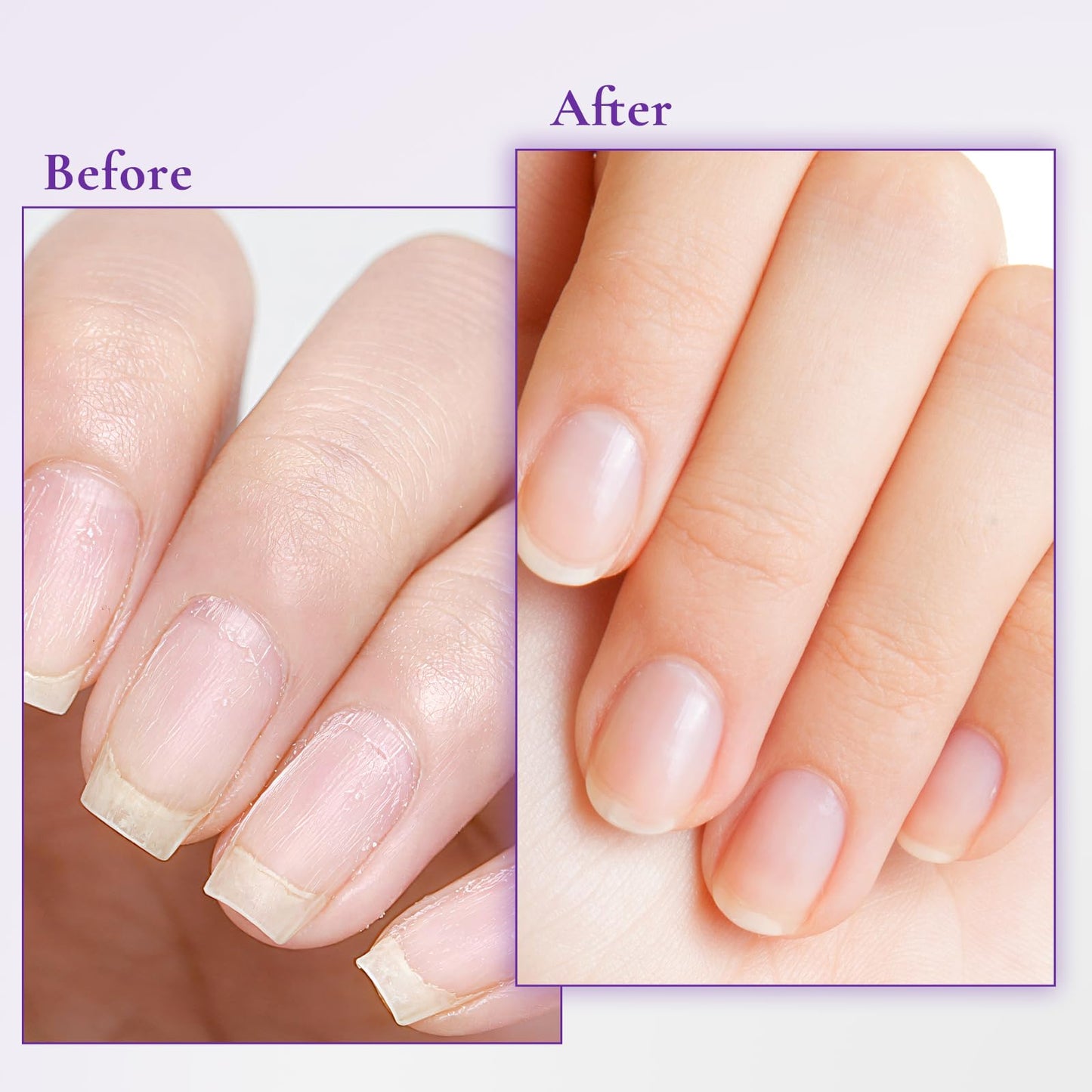 WM WONDER MOJO Nail & Cuticle Cream with Keratin, Biotin & Ceramides, Non-Greasy Cuticle Moisturizer for Dry Cracked Cuticles, Daily Nail Care After Manicures, 0.5 Fl Oz, Pack of 1