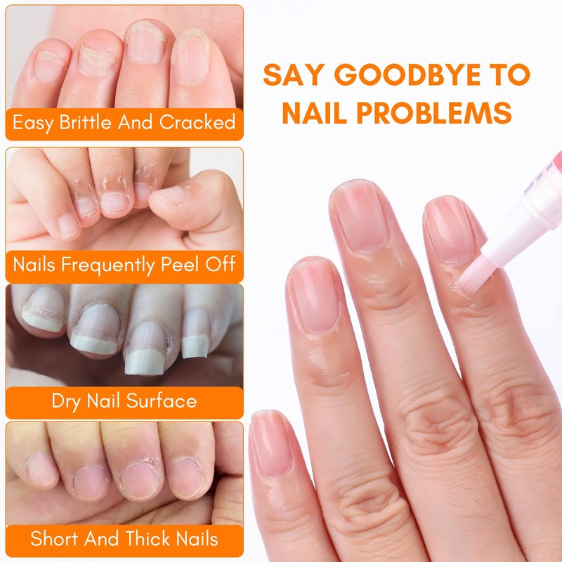 Makartt Cuticle Oil Pen Nail Care: 12pcs Repair and Softener with Vitamin E, Moisturizer Kit for Acrylic Nails, Art Accessory for Manicure and Pedicure, DIY Home Salon Use