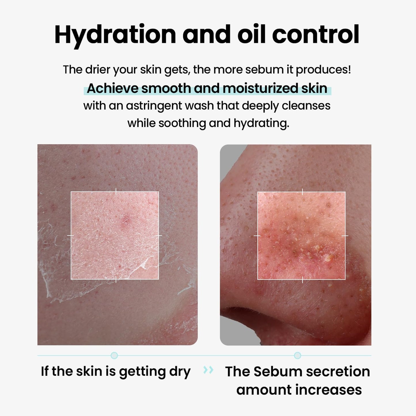 ilso Super Melting Sebum Cleansing Oil, Makeup & Blackhead Remover, 6.75oz