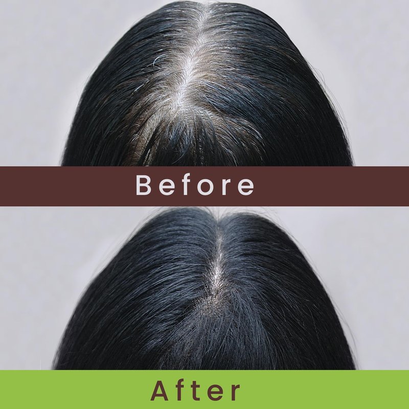 Nzuri Elixir Hair Skin and Nails Vitamins for Women and Men with Biotin, Folate, and Vitamin D for Daily Growth Supplement to Reducing Dryness, Thinning, and Loss, 32 oz.