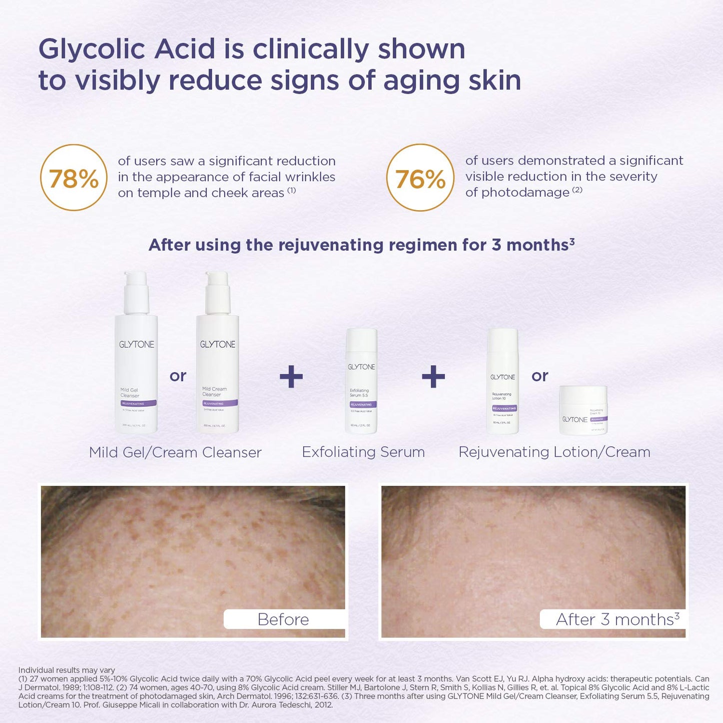 Glytone Mild Cream Cleanser | Exfoliate & Moisturize with 3.4 Free Acid Value Glycolic Acid & Glycerin | Face Wash for Women Removes Makeup & Oil | Face Cleanser for Dry Skin | 13.5 Fl oz.