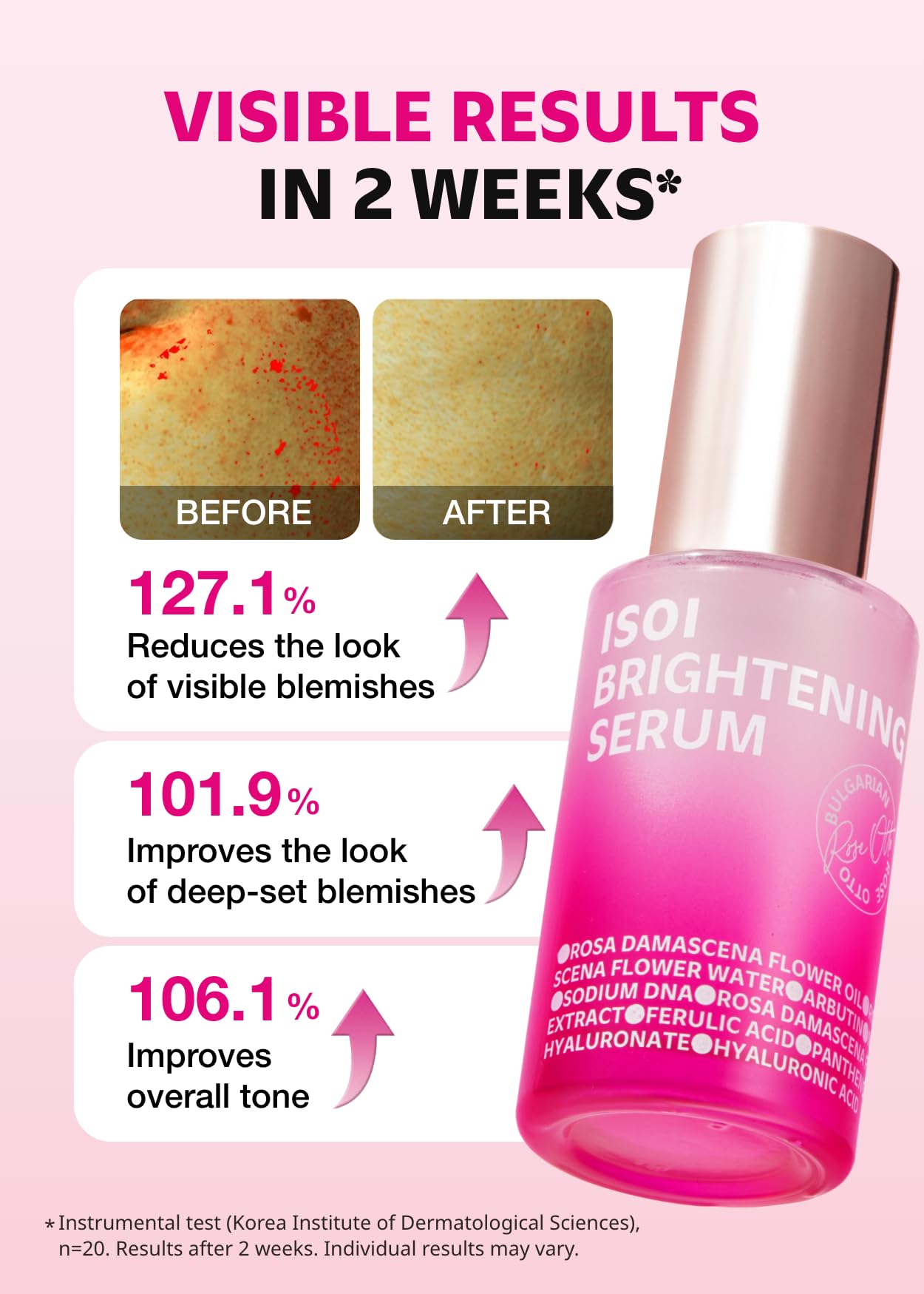 ISOI Rose PDRN Serum with Bulgarian Rose Oil, Radiance Face Serum