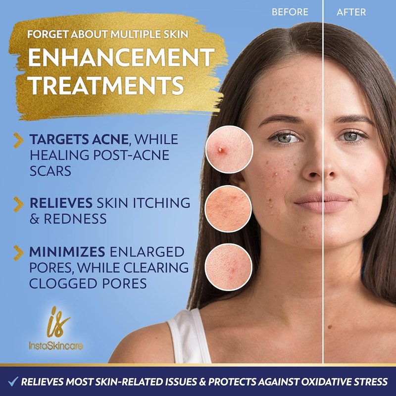 InstaSkincare Niacinamide Serum 8Oz for Face 10% with Zinc 1% Vitamin B3 Brightening Serum for Tone, Texture
