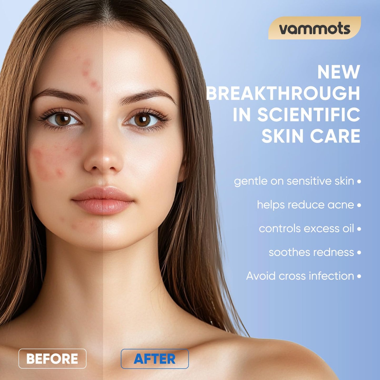 vammots Disposable Face Towels,Biodegradable Ultra Soft Washcloths for Sensitive Skin,Suitable for Facial Cleansing,Skin care and Makeup Removal,Lint-free,Trave,Daily Cleansing,300 Count