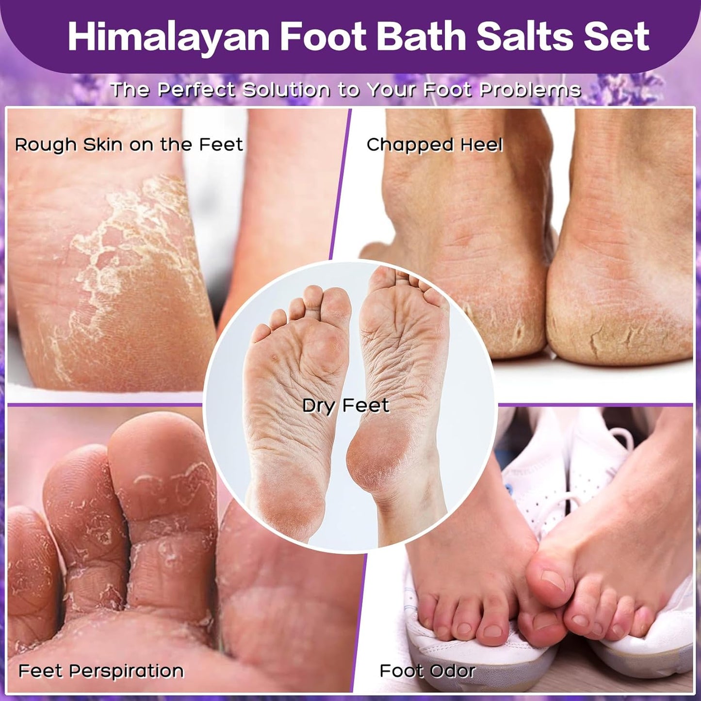 Himalayan Pink Salt Foot Soak Salts - Lavender & Tea Tree Oil | 56 OZ Kit for Athletes & Dry Skin Relief