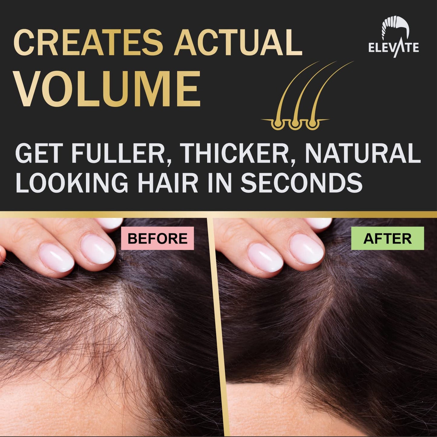 ELEVATE Hair Fibers to Instantly Thicken & Completely Conceal Thinning Balding Areas Loss in 30 Seconds for Men & Women (DARK BROWN) 28g Size - 100% Natural & Undetectable Keratin Fibers