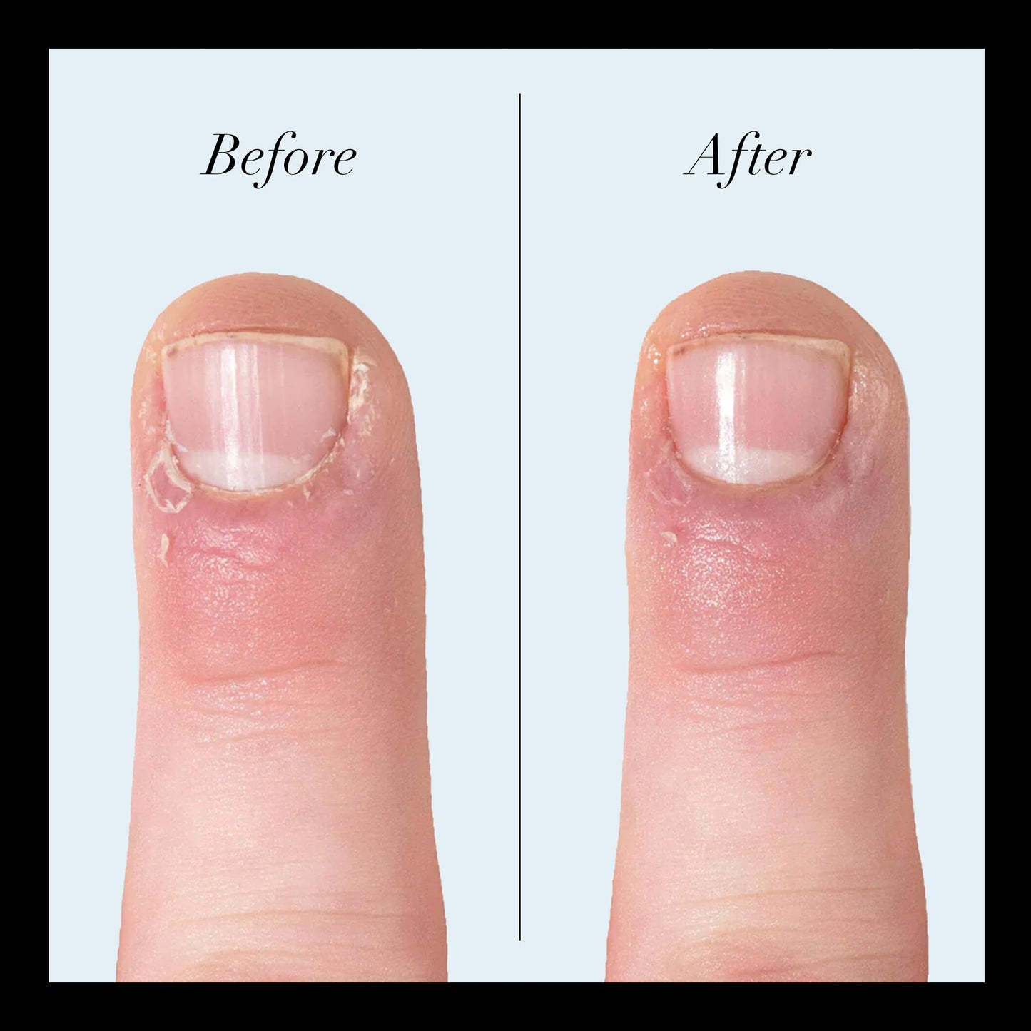 butter LONDON Quick Slip Cuticle Oil for Nails, Manicure and Pedicure Prep