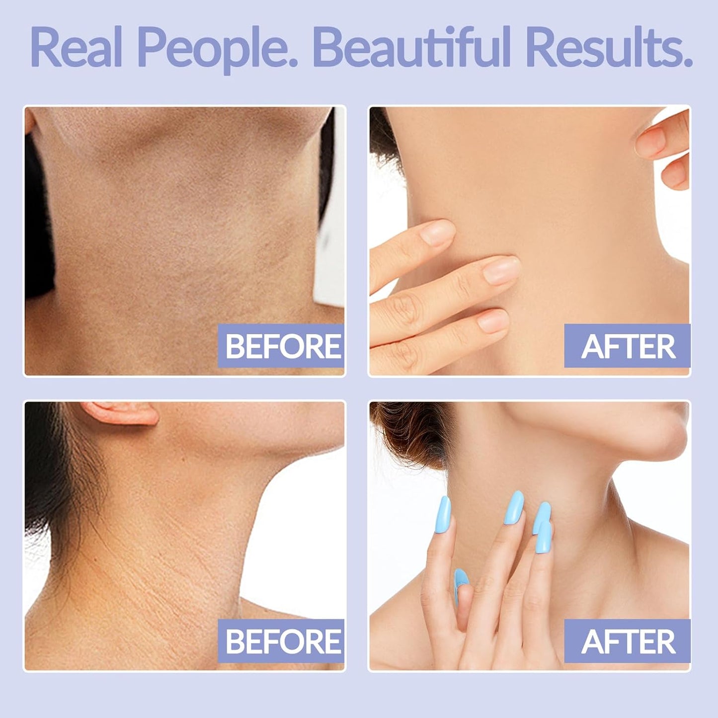 Neck Firming Cream - Anti-Aging Tightening & Lifting Formula for Sagging Skin | 1.7 oz