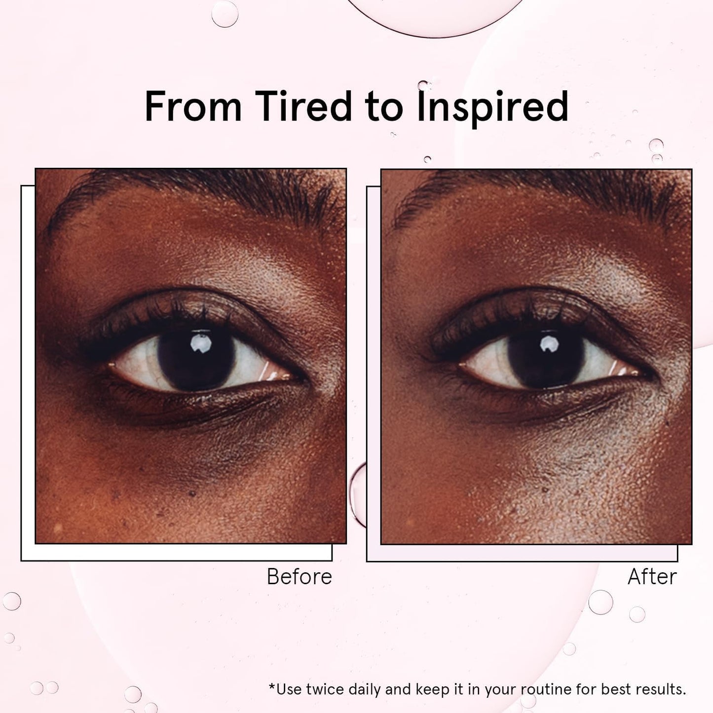 grace & stella Under Eye Brightener with Cooling Metal Rollerball - Ceramide & Caffeine Eye Cream for Puffy Eyes - Travel Size Toiletries - Vegan Skincare
