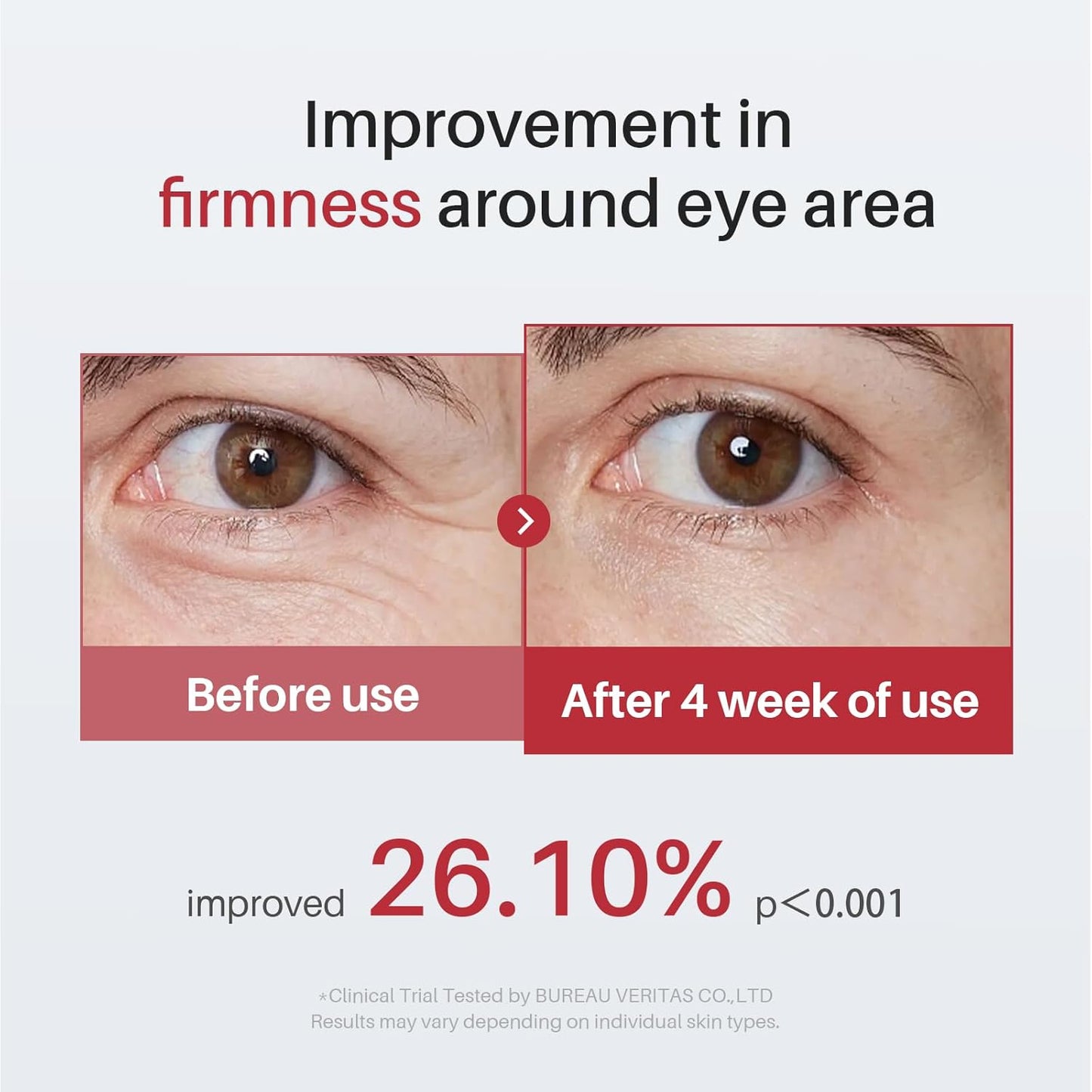 Eye Serum for Dark Circles - Caffeine, Retinol & Hyaluronic Acid | 360° Massage Ball, 0.5 fl oz