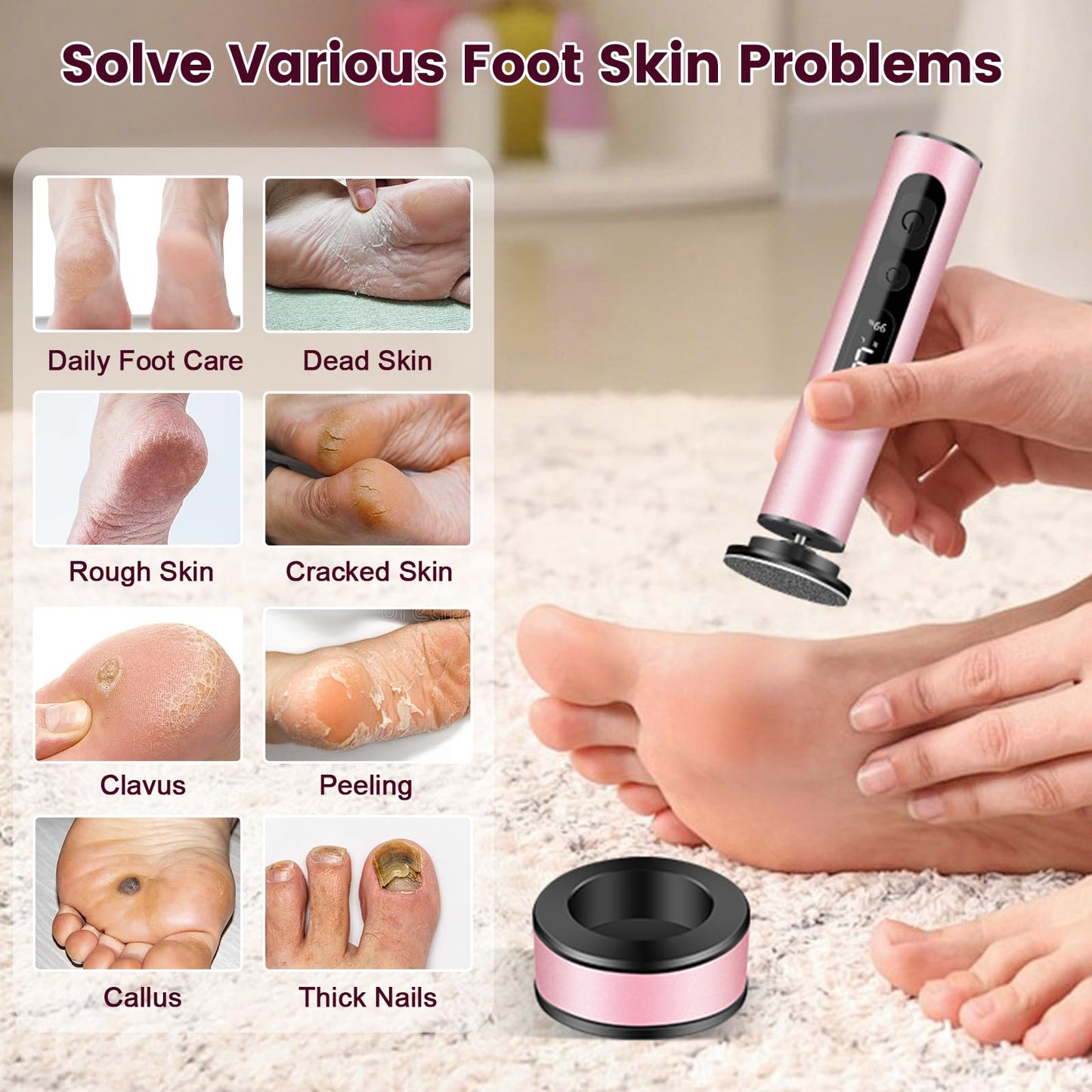 EFCRBS Electric Foot Callus Remover with LED Battery Level (Pink)