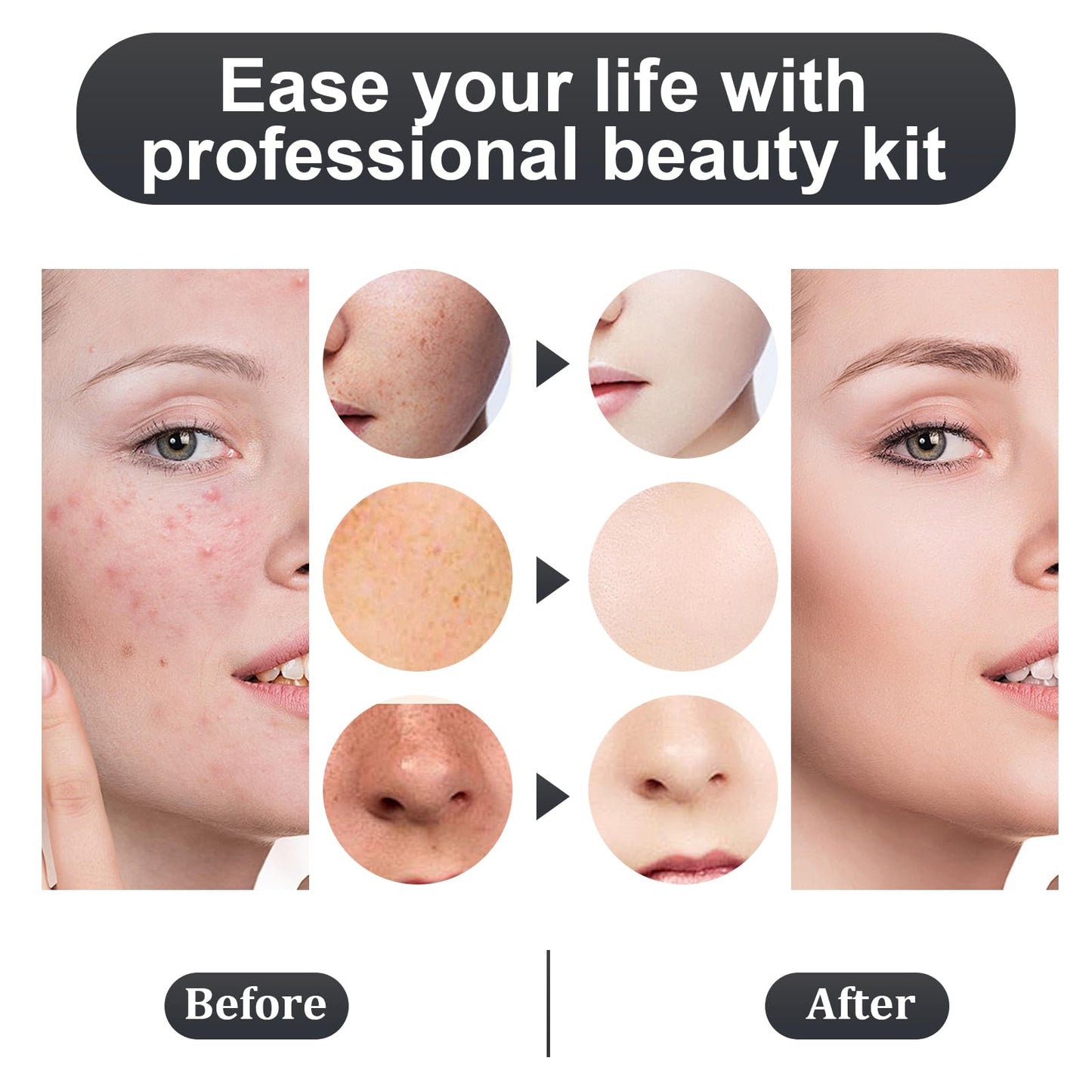 Meidaier 11Pcs Blackhead Remover Kit, Stainless Steel Acne Comedone Extractor with 10X Magnifying Glass & 20 75% Alcohol Pads, Pimple Whitehead Blemish Removal, Anti-Slip Handle & Storage Box
