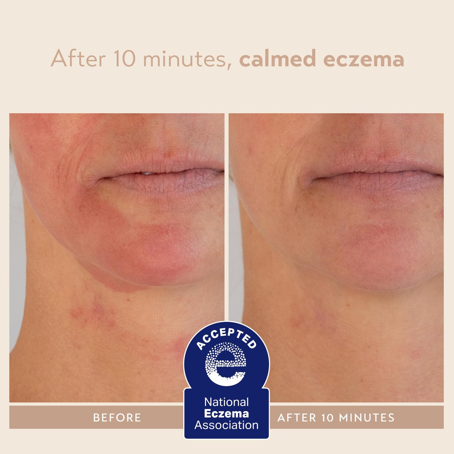 SHANI DARDEN SKIN CARE Signature Nourishing Facial Mask, A Nourishing Bentonite Clay Mask for Soothing Face Redness and Irritation with Colloidal Oatmeal and Squalane, 2.1 fl oz