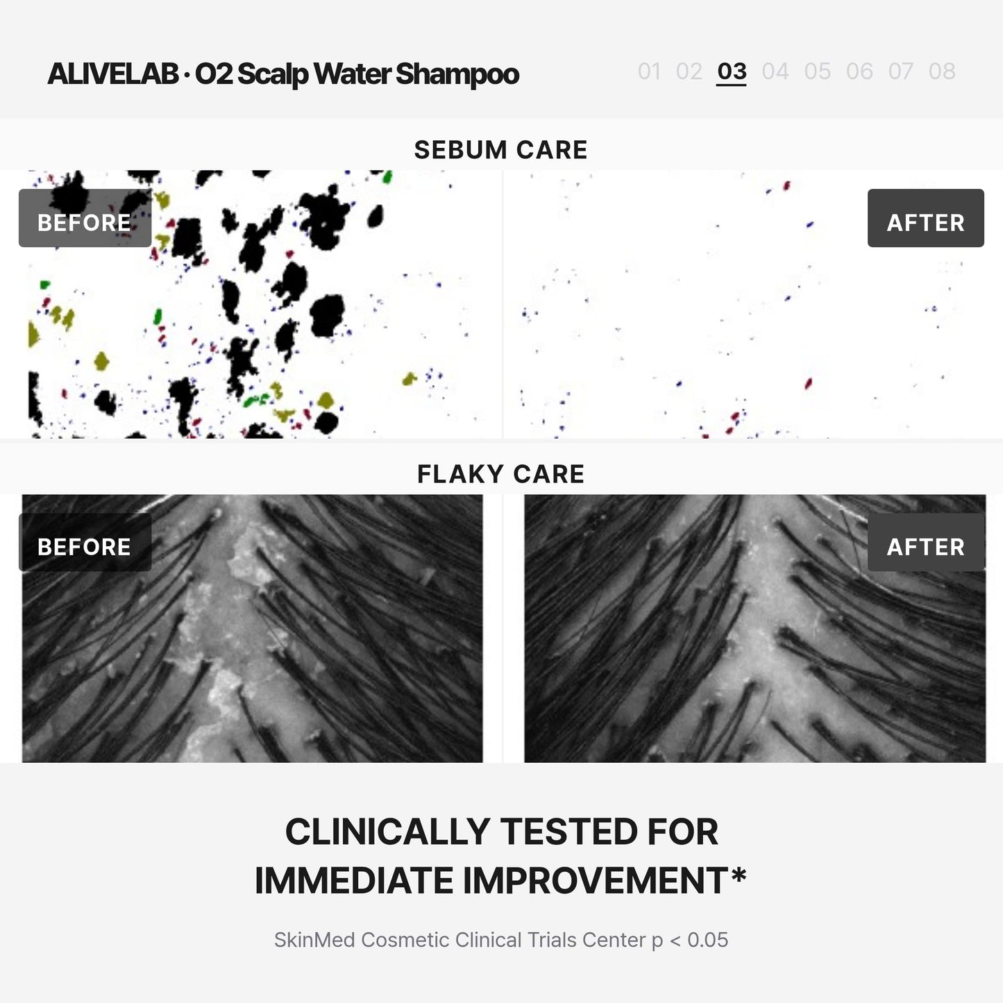 ALIVELAB O2 Scalp Water Shampoo for Sensitive Scalp, Itchy, Anti Dandruff, Deep Cleansing and Soothing, Hair Care, Scalp cleanser, Water Type, Liquid shampoo, Silicone-Free 11.83 fl oz