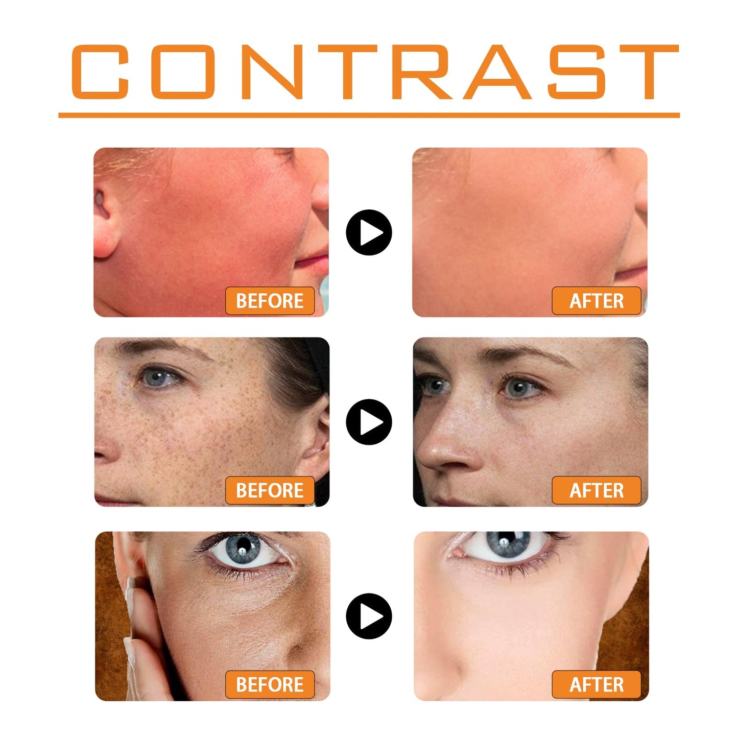 Antioxidant-Infused Sunscreen SPF 100 Broad Spectrum, Face & Body Oil-Free Oxybenzone-Free, Designed for Sun Sensitive Skin