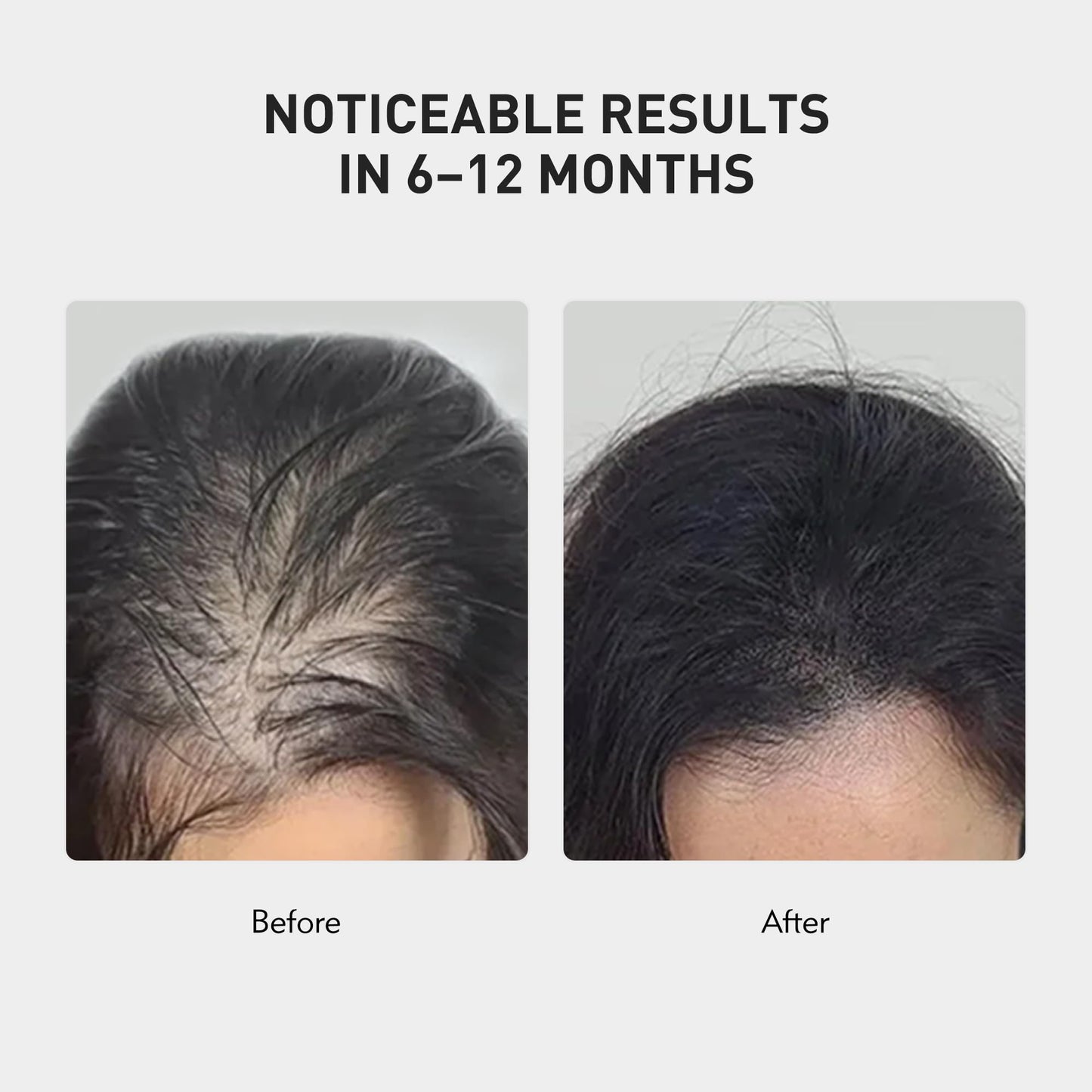 0.9% KX-826 KINTOR Hair Growth Spray,Strengthen Hair Nourish Hair follicles,Hair Care Products for Sparse Hair and Oily Hair Men&Women,60ml,Pro