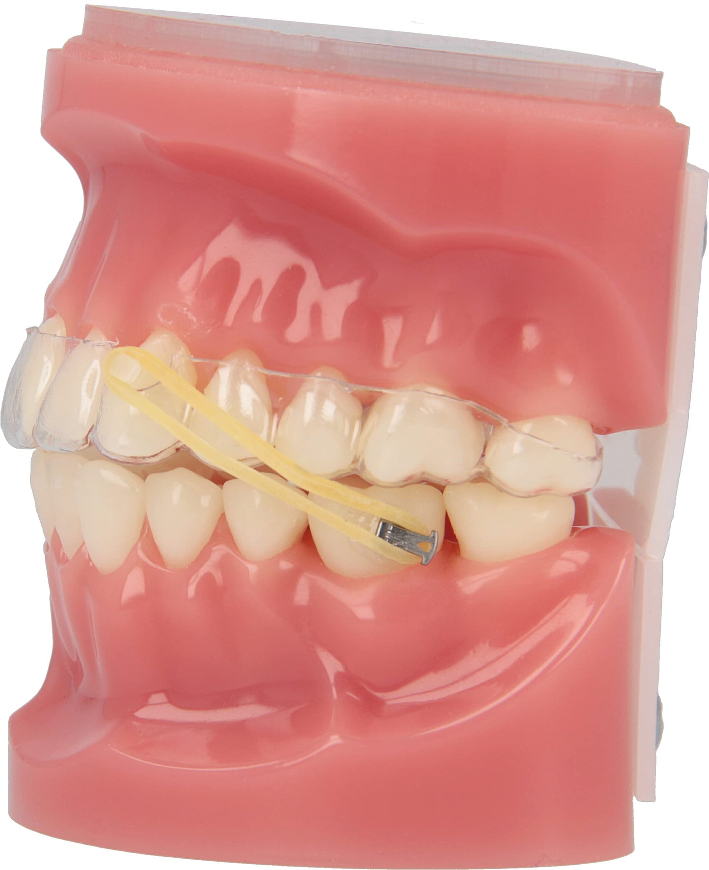 American Orthodontics Elastics Wildlife Gorilla | Medium, 4.5 Oz, 3/16" Size, 100 Packs Per Box, 10,000 Total | Made in The USA | Exacting Dimensions, Precision Cutting, Top Quality Latex Tubing