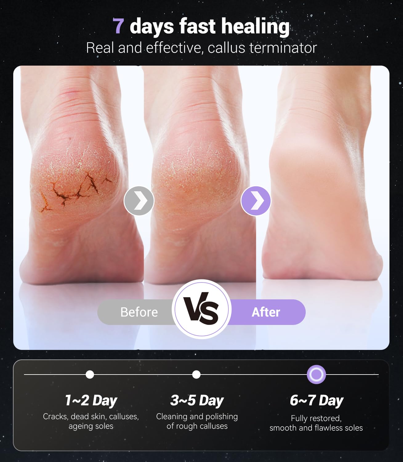 5-in-1 Professional Electric Callus Remover(Portable & Foldable), Removes 99.92% of Calluses in 3 Mins, Rechargeable Foot File Pedicure Kits with 10 & 40 Grit Pads for Soft Smooth Feet, Purple