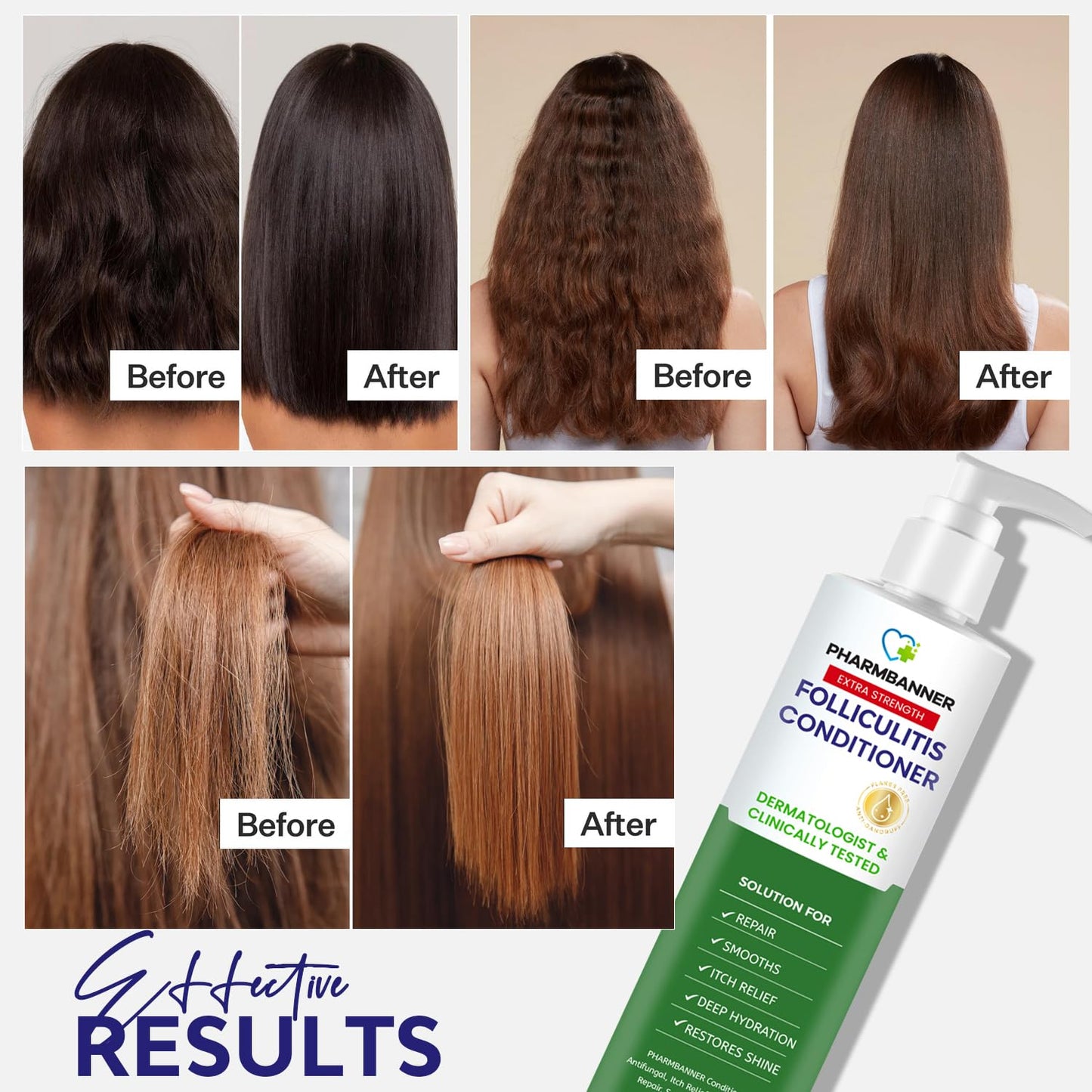 PHARMBANNER Anti-Dandruff Shampoo & Conditioner: Tea Tree Oil & Moroccan Argan Oil - Deep Hydration & Repair - Nourishes, Smooths, Restores Shine - Safe for Dry or Damaged Hair