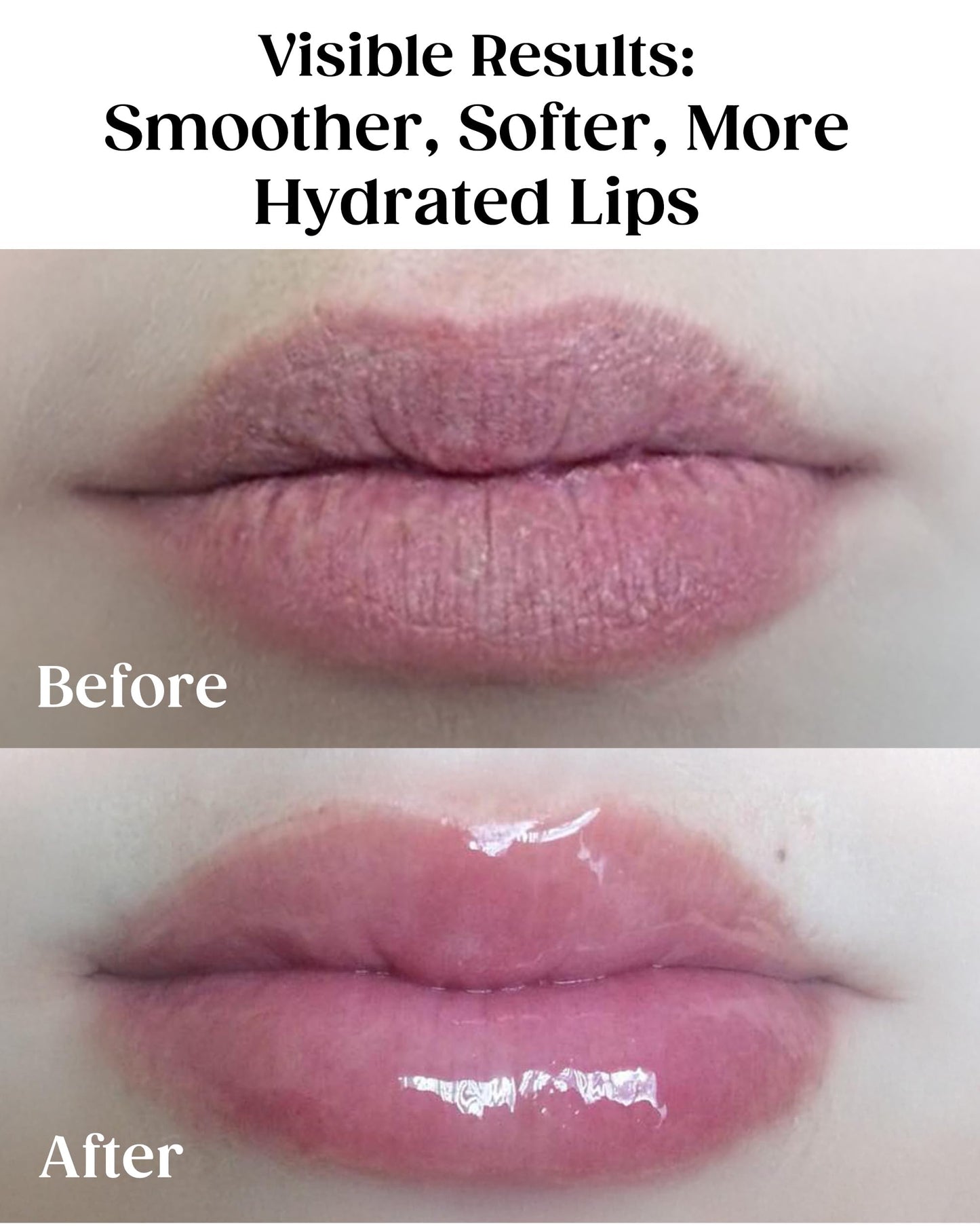 KAPLAN MD Perfect Pout Duo Lip Mask (0.5 oz.) & Lip Balm 0.17 oz. - Complete Anti-Aging Skin Care for Lips