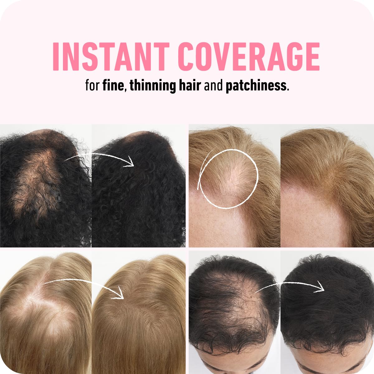 BOLDIFY Hair Fibers - Fill In Thinning and Fine Hair for an Instantly Fuller, Thicker Look - 14 Shades for Women & Men