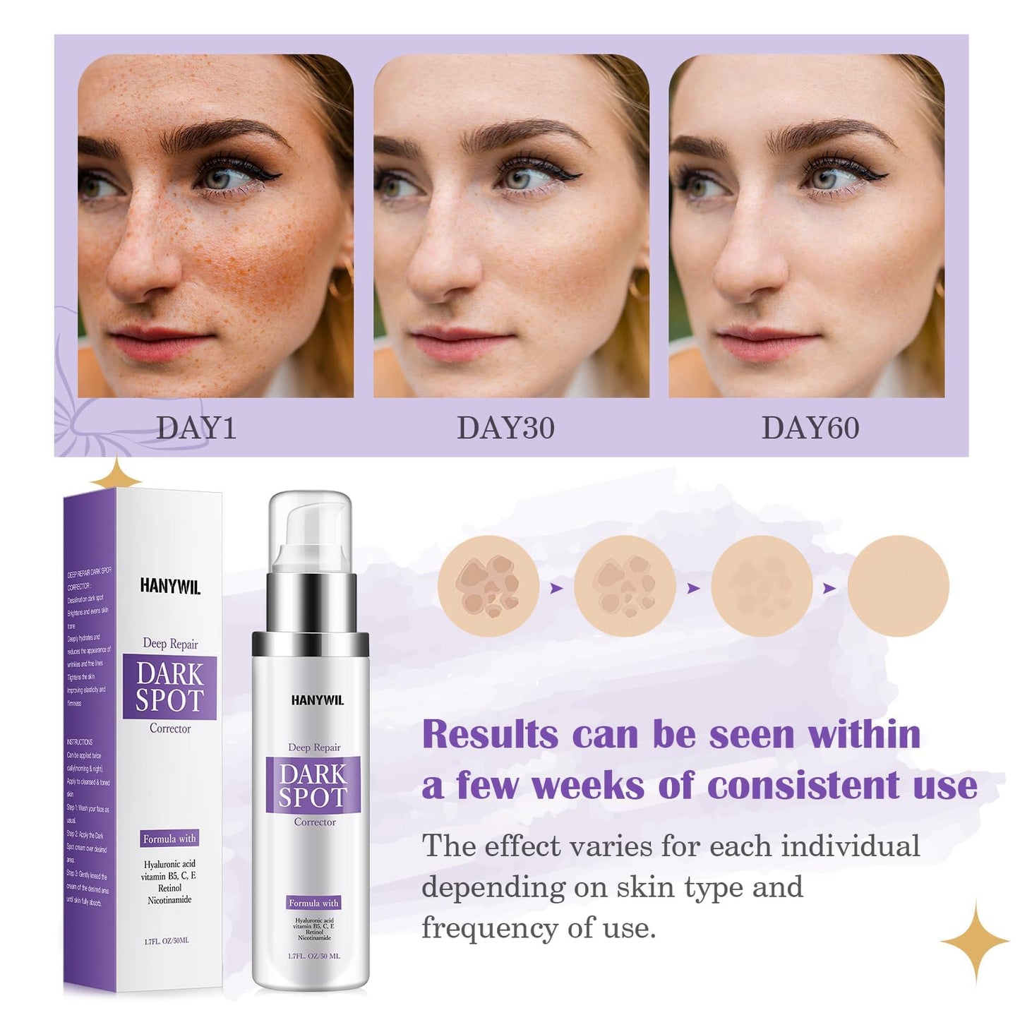 HANYWIL Dark Spot Remover for Face & Body Serum - 2% Retinol + 5% Niacinamide + Vitamin C for Face & Body, Melasma & Hyperpigmentation Treatment,Dermatologist Tested,1.7 Fl Oz