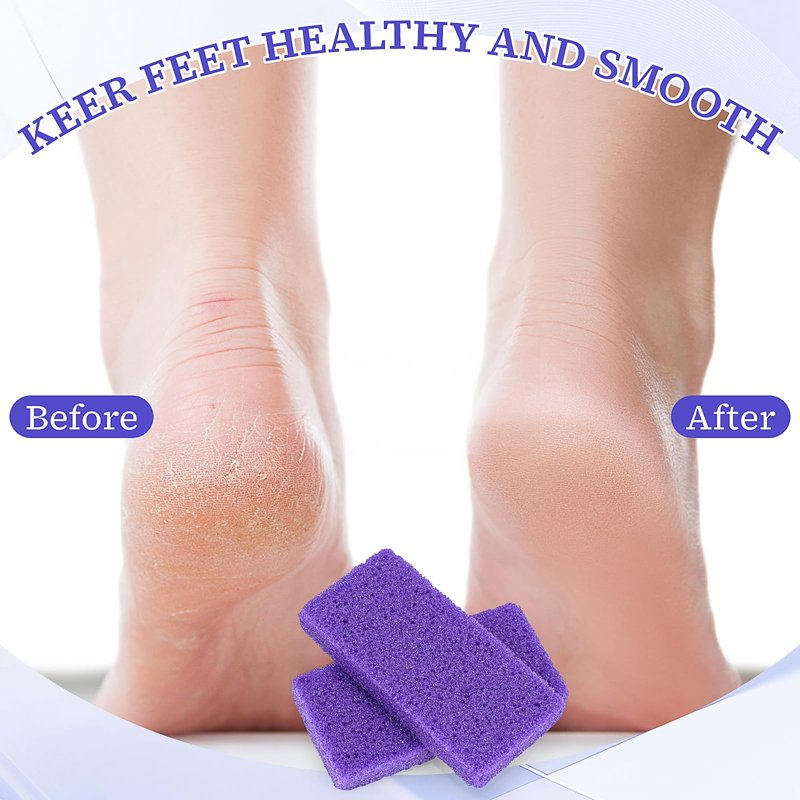 200 Pcs Pumice Stone Bulk for Feet Scrubber,Dead Skin Disposable Foot Pumice Foot Callus Remover Pedicure Tools Purple Pumice Sponge Nail Salon Home Use