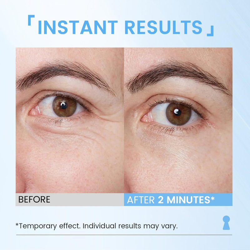 RONKIE Instant Eye Face Lift Cream: Reduces Eye Bags Wrinkles Puffy Eyes Dark Circles Crow’s Feet in Minutes for Mature Skin of Middle-aged Women 1 Fl Oz