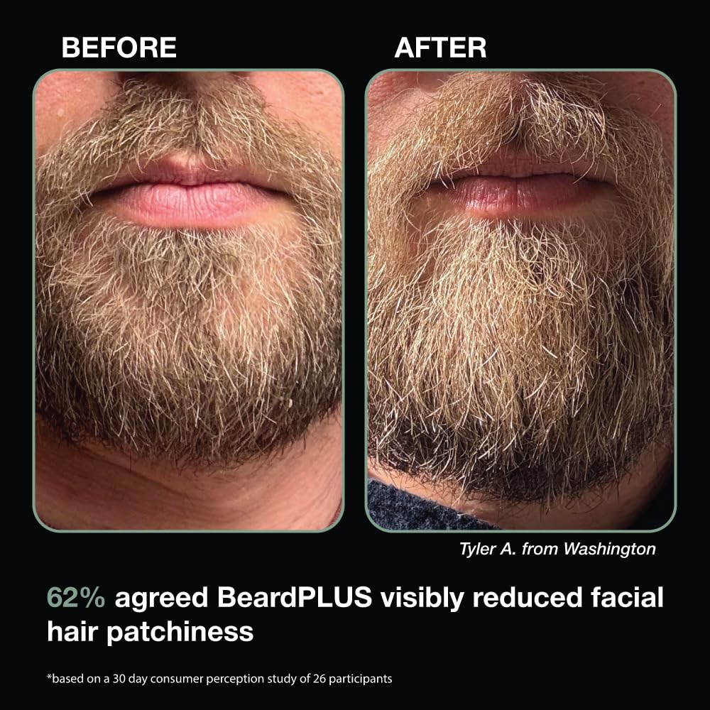 ZEUS BeardPLUS Conditioner for Men - Biotin & Caffeine Beard Growth Treatment | 6 oz for Thickness & Hydration