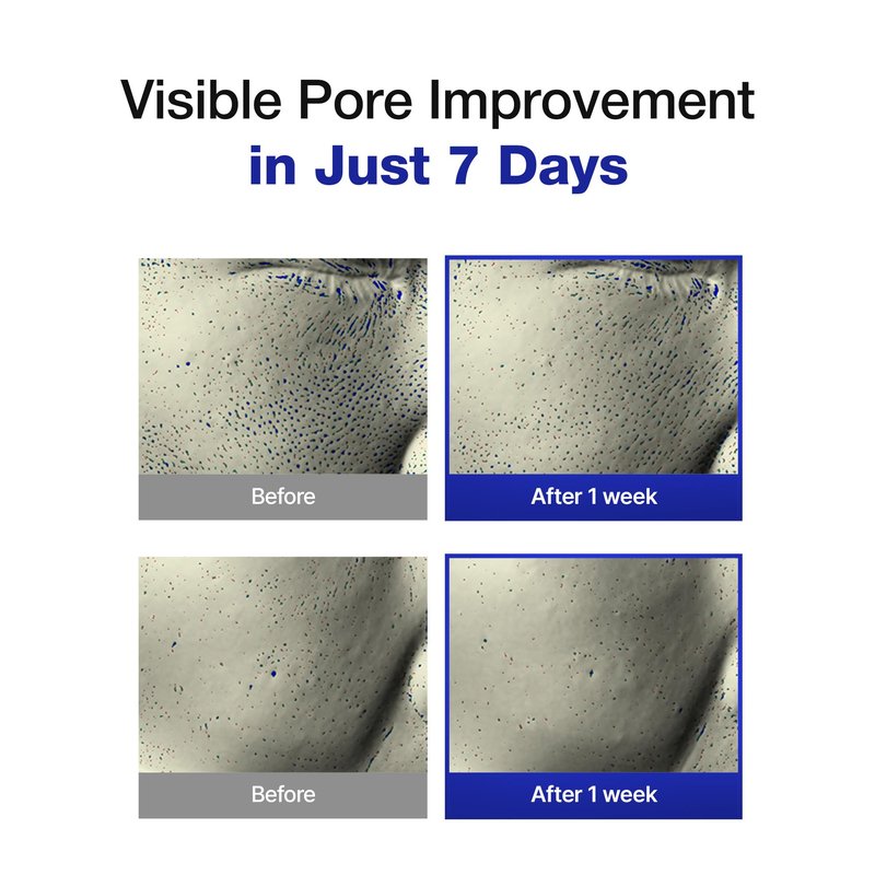 Brightening Exfoliating Pads | 35% Smaller Pores | AHA BHA PHA Exfoliation for Pores & Texture | Brightening & Hydrating Korean Skincare| Sensitive & Acne-Prone Skin | 70 Pads